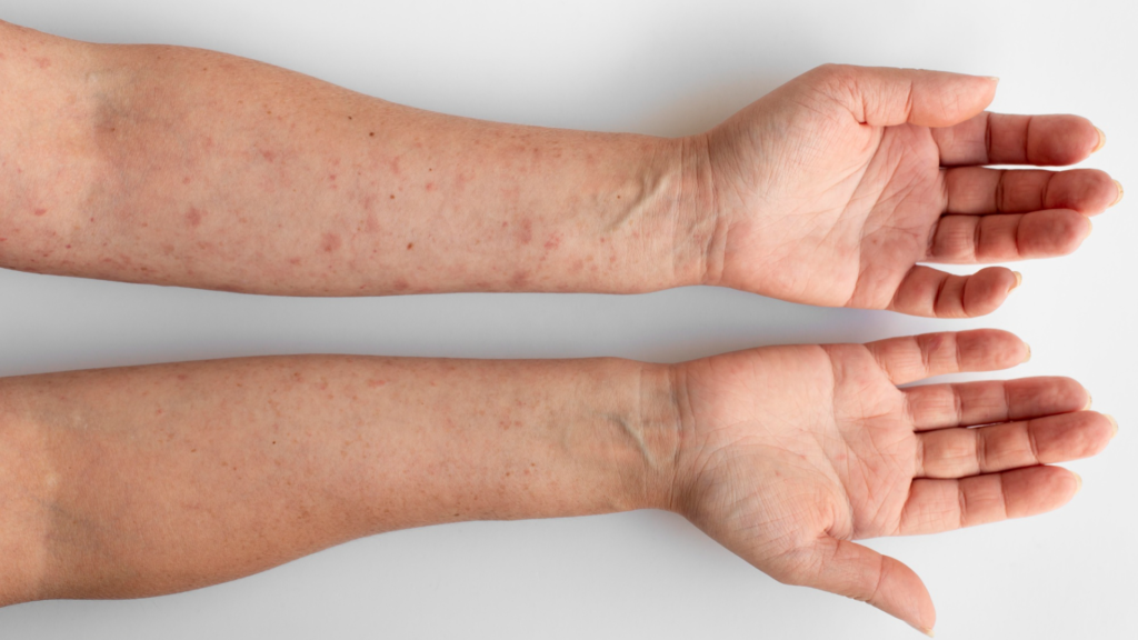 Изменение текстуры кожи