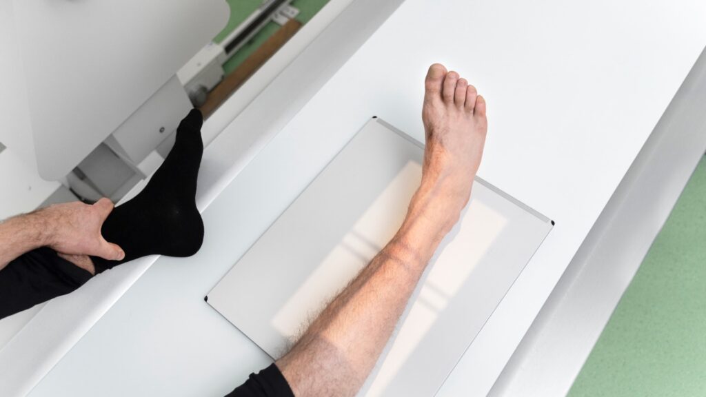 Диагностика Халюса Вальгуса