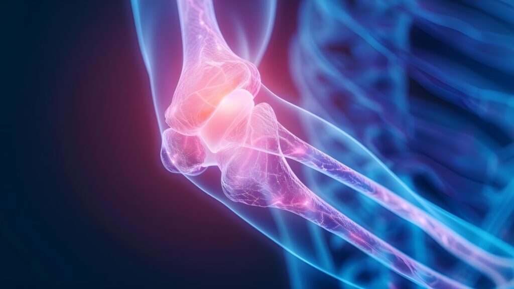 Фасцит локтевого сустава в Израиле - масштаб проблемы