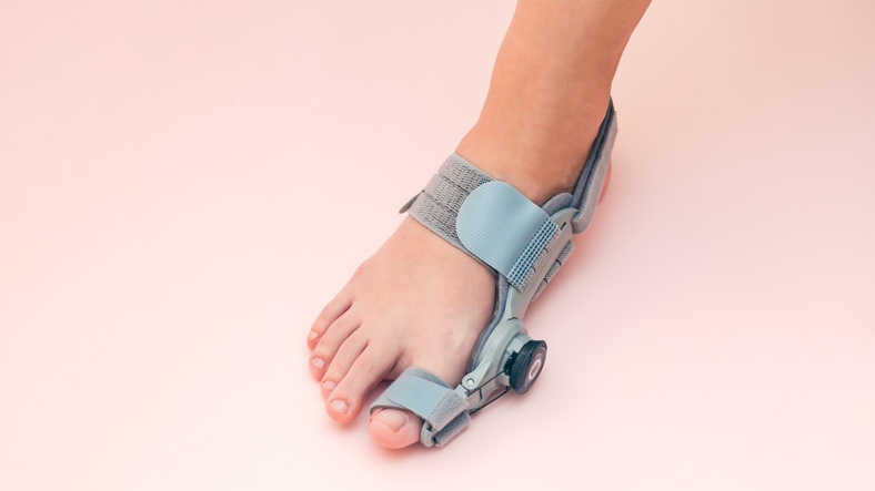 Халюс Вальгус (косточка) – причины, симптомы, диагностика, лечение в Израиле